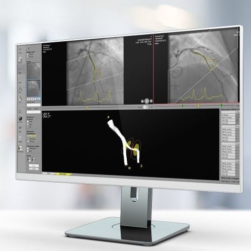 Программное обеспечение для анализа - QCA  - Pie Medical Imaging - для составления отчетности / калибровки / для определения контуров