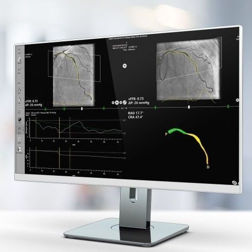 Программное обеспечение для анализа - vFFR - Pie Medical Imaging - для визуализации 3D / медицинское / для больниц