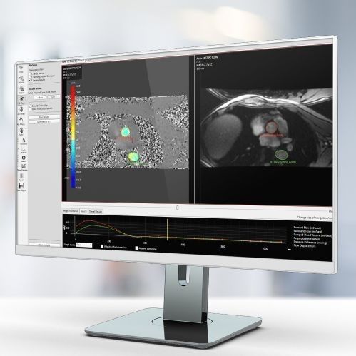 Программное обеспечение для больниц - Pie Medical Imaging - клиническое / для МРТ / для ангиографии