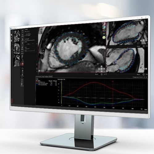 Программное обеспечение для анализа - MR Strain - Pie Medical Imaging - с системой отслеживания / медицинское / клиническое