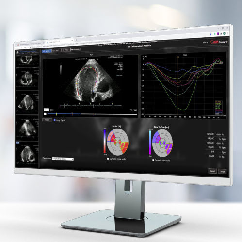 Медицинское программное обеспечение - Qardia - Pie Medical Imaging - клиническое / для ультразвуковых исследований / для эхокардиографии