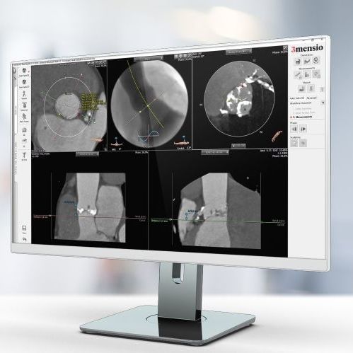Медицинское программное обеспечение - Pie Medical Imaging - TDM / для кардиологии / для анализа