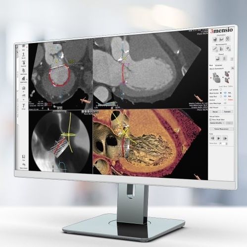 Медицинское программное обеспечение - Pie Medical Imaging - TDM / для кардиологии / для анализа