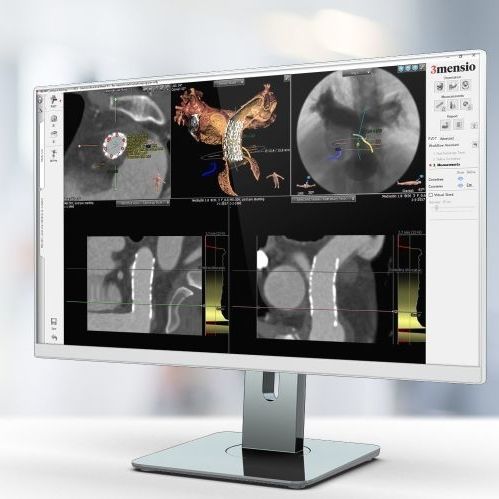 Программное обеспечение для составления отчетности - Pie Medical Imaging - для планирования / для обработки / для больниц