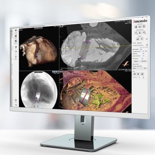 Медицинское программное обеспечение - Pie Medical Imaging - для анализа изображений / для составления отчетности / для импортации