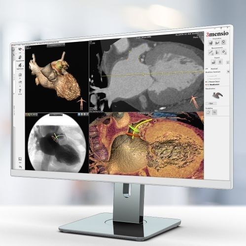 Медицинский модуль программного обеспечения - Pie Medical Imaging - TDM / для МРТ / для аппендэктомии