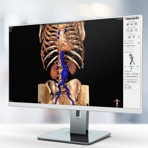 Медицинское программное обеспечение - Pie Medical Imaging - TDM / для системы архивации и передачи изображений / DICOM-файла