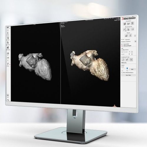 Программное обеспечение TDM - Pie Medical Imaging - для исследований / для захвата / для печати 3D