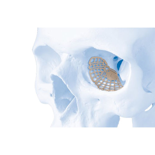 Имплантат параорбитальной области нерассасывающийся - MatrixORBITAL™ - Depuy Synthes
