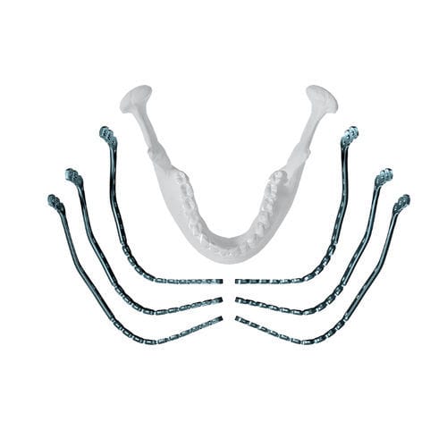 Компрессионная костная пластина для нижней челюсти - MatrixMANDIBLE™  - Depuy Synthes - дистальная / блокируемая / металлическая
