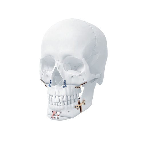 Компрессионная костная пластина для нижней челюсти - MatrixORTHOGNATHIC™ - Depuy Synthes - челюстное / блокируемая / металлическая