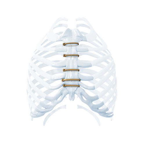 Ортопедическая проволока для закрытия груди - ZIPFIX™ - Depuy Synthes - металлический монофиламент