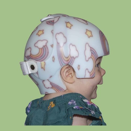 Черепной ортез - STARband Bi-Valve - Orthomerica - педиатрический