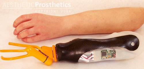 Миоэлектрический протез руки - Aesthetic Prosthetics - корнцанг / для взрослых