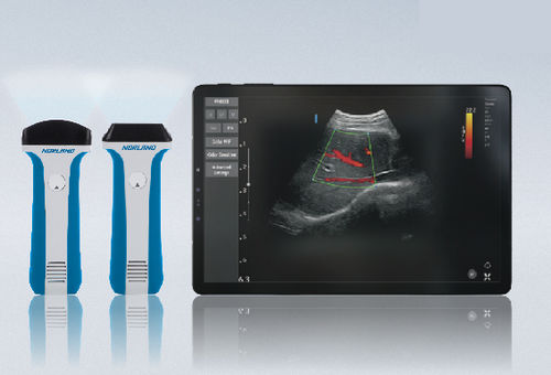 Портативный ультразвуковой сканер - uREzpocus - Swissray - для поливалентной эхографии / черно-белый / цветовой допплер