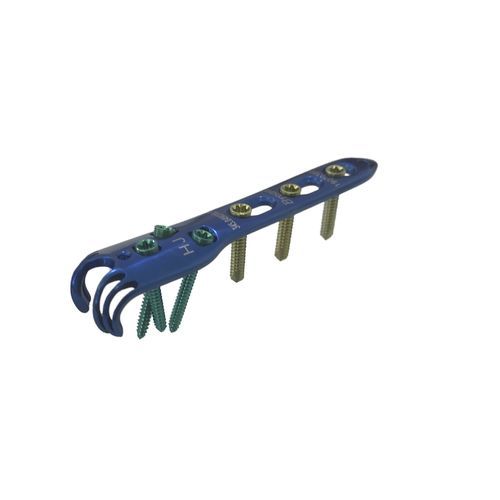 Компрессионная костная пластина локтевая кость - HJ-Mini VA-LCP 01 - Health-Joy Medical - дистальная / блокируемая / неблокируемая
