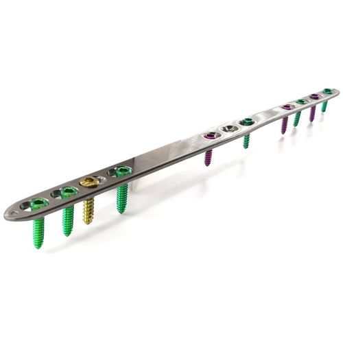 Костная пластина для артродеза для запястья - HJ-Small Dorsal Spanning - Health-Joy Medical - для лучезапястного сустава / для фаланги руки / пястно-фаланговый сустав