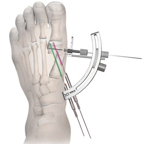 Комплект инструментов для миниинвазивной хирургии плюсны - HJ-Bunion  - Health-Joy Medical