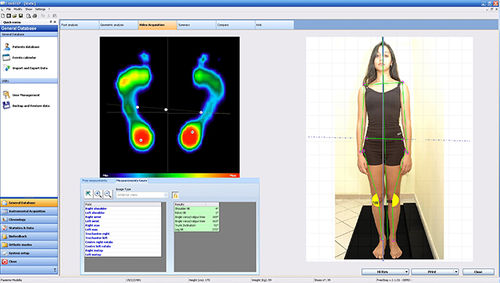 Программное обеспечение для анализа - Sensor Medica - для лечения заболеваний стоп