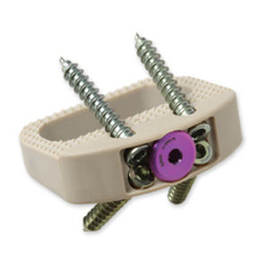 Межтеловой кейдж для поясничной зоны - Vault® - Precision Spine - через передний отдел / из ПЭЭК