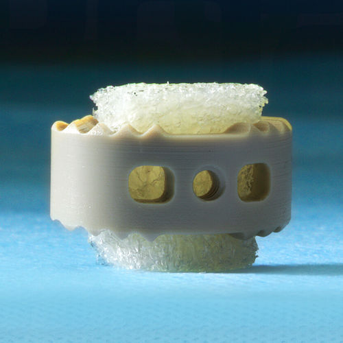 Костный заменитель аллогенный трансплантат - 3D Profuse® - Alphatec Spine - для ортопедической хирургии / гибкий