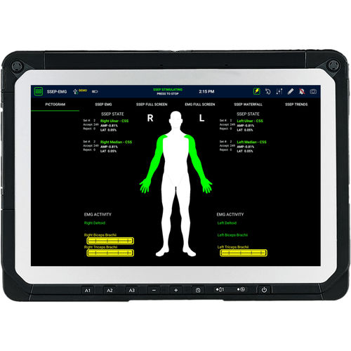 Система информации для мониторинга - SafeOp™ - Alphatec Spine - для нейрохирургии / ортодонтическая