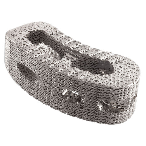 Межтеловой кейдж для грудо-поясничной зоны - IdentiTi™-PC - Alphatec Spine - через задний отдел / из титана