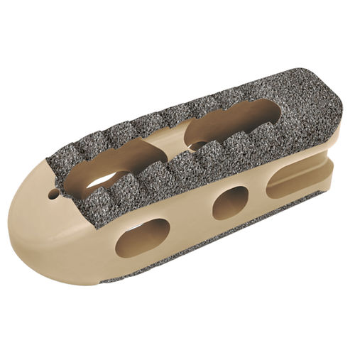 Межтеловой кейдж для поясничной зоны - Battalion™ PS - Alphatec Spine - через задний отдел / из титана / из ПЭЭК