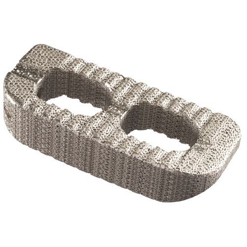 Межтеловой кейдж для торакальной зоны - IdentiTi™ LIF - Alphatec Spine - боковой доступ / из титана