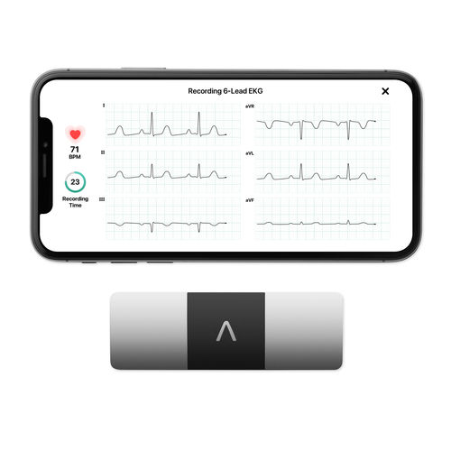 Портативный монитор пациента - KardiaMobile® 6L - AliveCor - для ЭКГ / для обслуживания пациентов на дому / для улицы