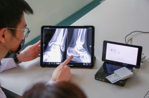 Медицинское приложение iOS - EXCD - EBM Technologies - для системы архивации и передачи изображений / визуализатор / сервер