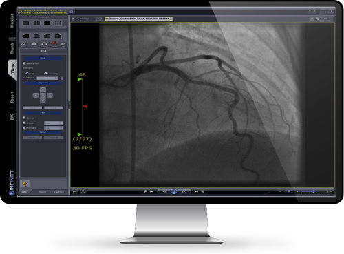 Программное обеспечение для анализа - Cath Lab - INFINITT North America - для управления / медицинское / для кардиологии