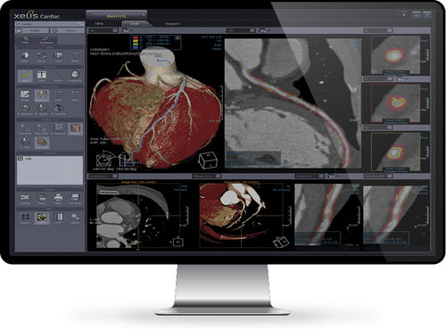 Программное обеспечение для анализа - Xelis™ Cardiac - INFINITT North America - для визуализации 3D / для диагностики / для измерений