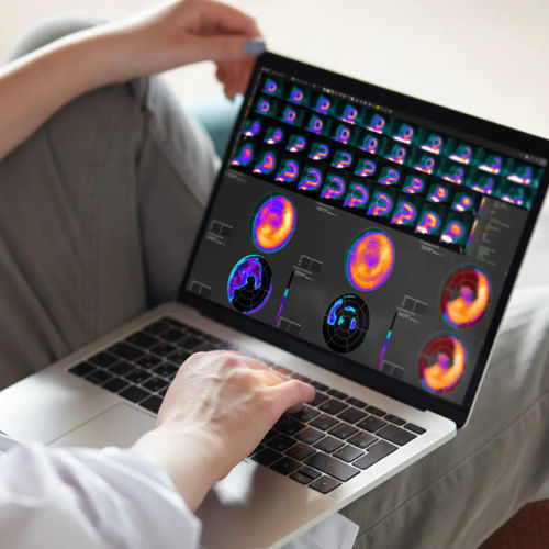 Клиническое программное обеспечение - MIMcardiac® - MIM Software - TDM / TEP / SPECT