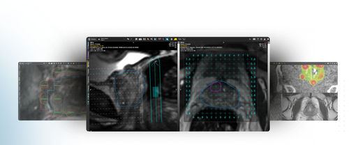 Программное обеспечение для визуализации 3D - MIM Symphony LDR™ - MIM Software - для приобретения / для планирования / для планирования лечения