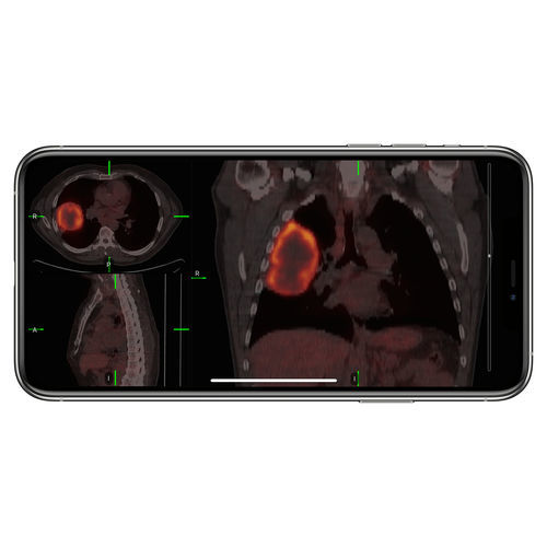 Приложение iOS для контроля доступа - VueMe™ - MIM Software - для импортации / для медицинских снимков / iOS