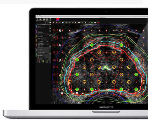 Программное обеспечение для анализа - MIM Symphony Dx™ - MIM Software - для управления / для составления отчетности / для визуализации