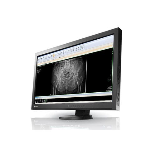 Информационная рабочая станция для диагностики - IDETEC MEDICAL IMAGING - для рентгенологии