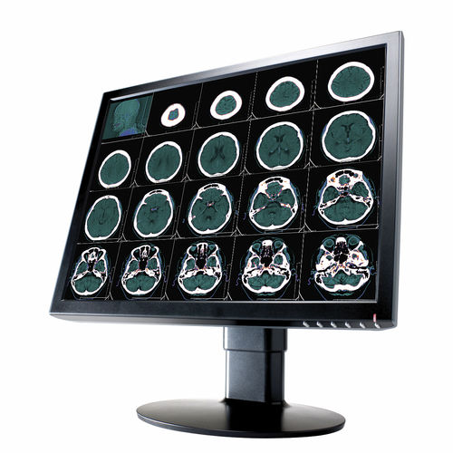 Медицинский монитор - 2 MP | CL2000 - Richardson Electronics - Healthcare - для диагностики / для рентгенологии / 20,1"