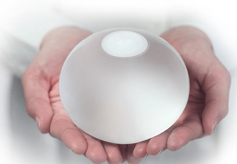 Нехирургический внутрижелудочный баллон - ORBERA® - Apollo Endosurgery