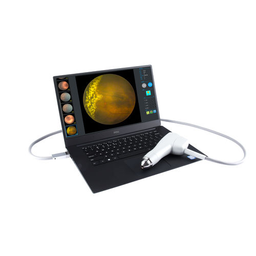 Немидриатическая ретинальная камера - SW-8000P - Tianjin Suowei Electronic Technology - флуоресцентная ангиография глаза / портативный