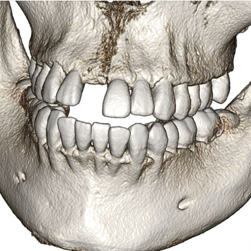 Программное обеспечение для стоматологии -  Invivo6 - Anatomage - медицинское / TDM / для анализа