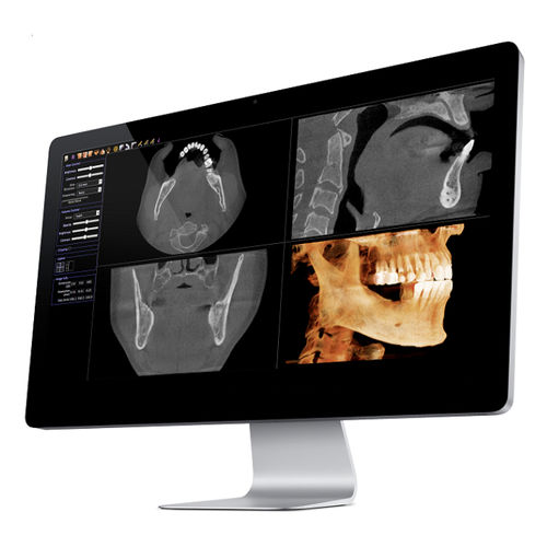 Программное обеспечение для визуализации 3D - Invivo - Anatomage - для измерений / для обмена информацией / медицинское