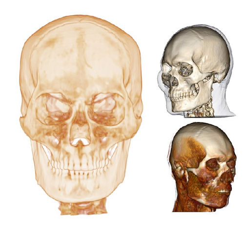 Медицинское программное обеспечение - Medical Design Studio - Anatomage - анатомическое / для визуализации 3D / для разработки