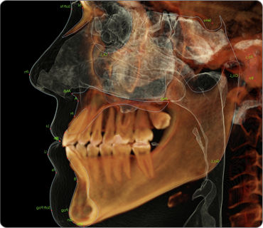 Модуль программного обеспечения для обработки снимков зубов - Anatomage - ортодонтический / хирургический / для цефалометрического анализа