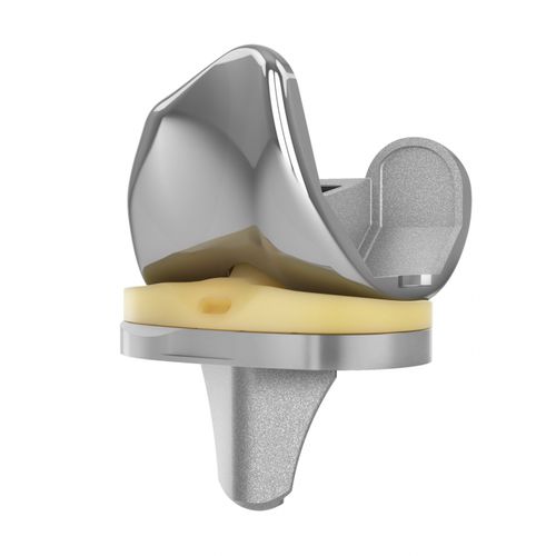 Коленный протез с 3 отсеками - EMPOWR PS ® - Trilliant Surgical - с фиксированным вкладышем