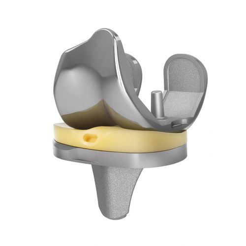 Коленный протез с 3 отсеками - EMPOWR 3D® - Trilliant Surgical - с фиксированным вкладышем / с цементом