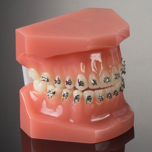 Ортодонтические скобы из металла - miniPrevail® - G&H Orthodontics - двойная / мини