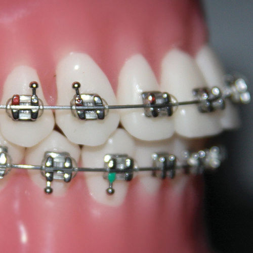 Ортодонтические скобы из металла - Focus™  - G&H Orthodontics - мини