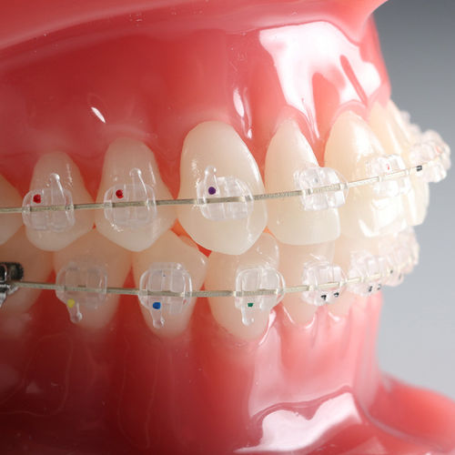 Эстетическая ортодонтические скобы - Vapor™ - G&H Orthodontics - из керамики / прозрачная